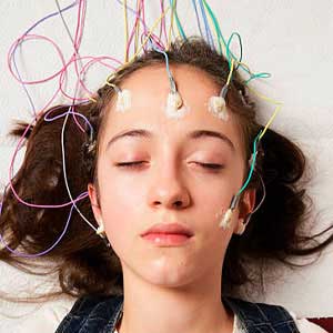 Epilepsy Treatment in Hyderabad